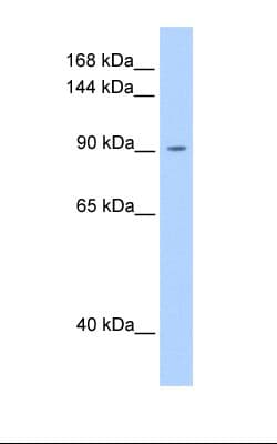 Polyclonal Rabbit anti-Human OSMR / IL-31R-Beta Antibody (FITC, aa21-70, WB)
