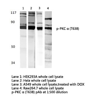 Polyclonal Rabbit anti-Human PRKCA / PKC-Alpha Antibody (phospho-Thr638, IHC, WB)