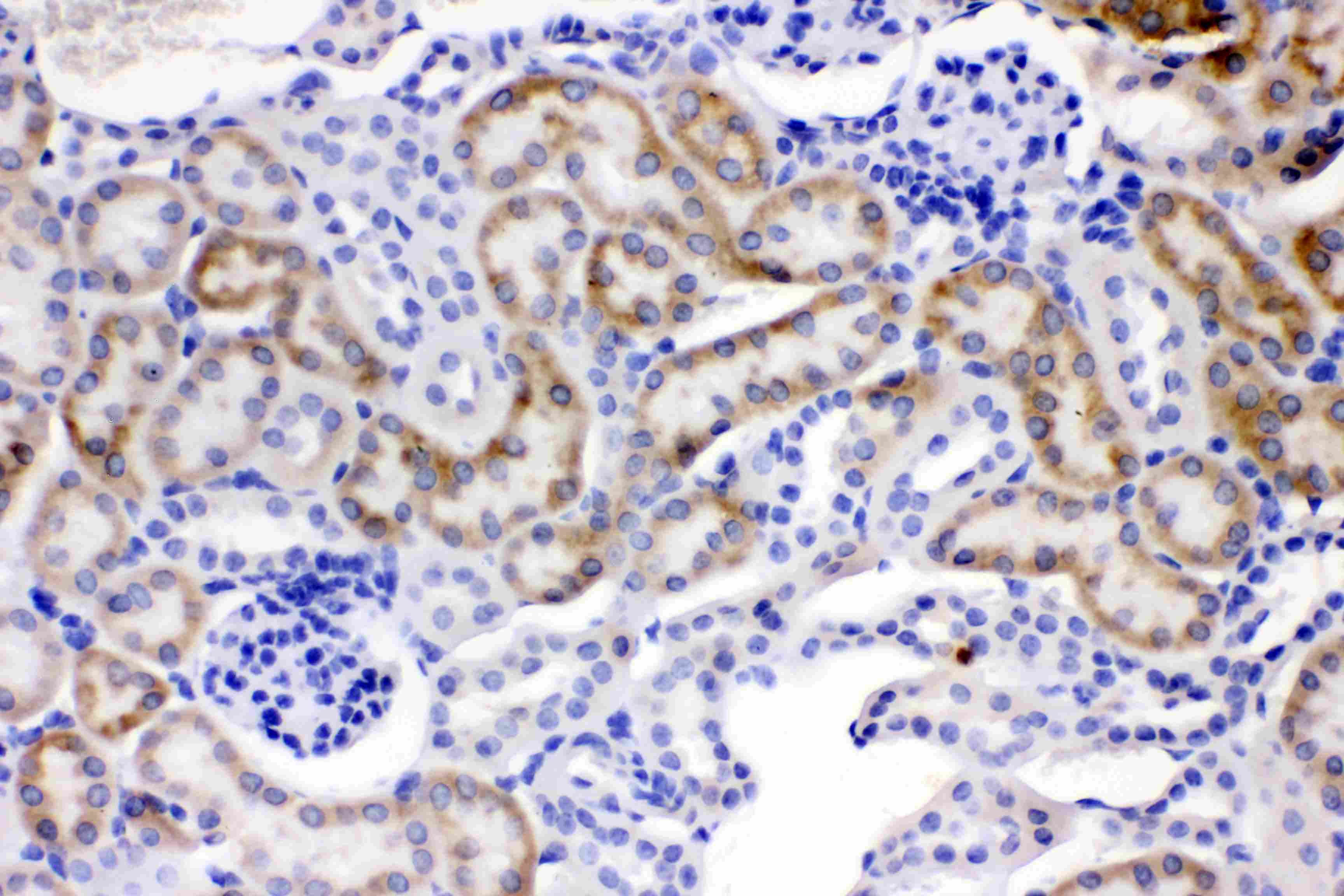 Polyclonal Rabbit anti-Human FACL2 / ACSL1 Antibody (IHC, WB)