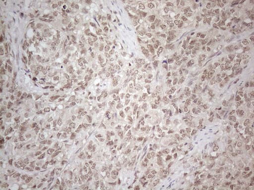 Monoclonal Mouse anti-Human MED15 / ARC105 Antibody (clone OTI2C6, Carrier-free, aa393-679, IHC)