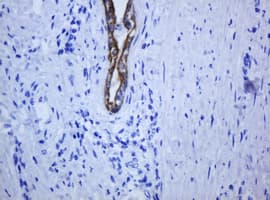 KRT5 / CK5 / Cytokeratin 5 Antibody (clone OTI4A7)