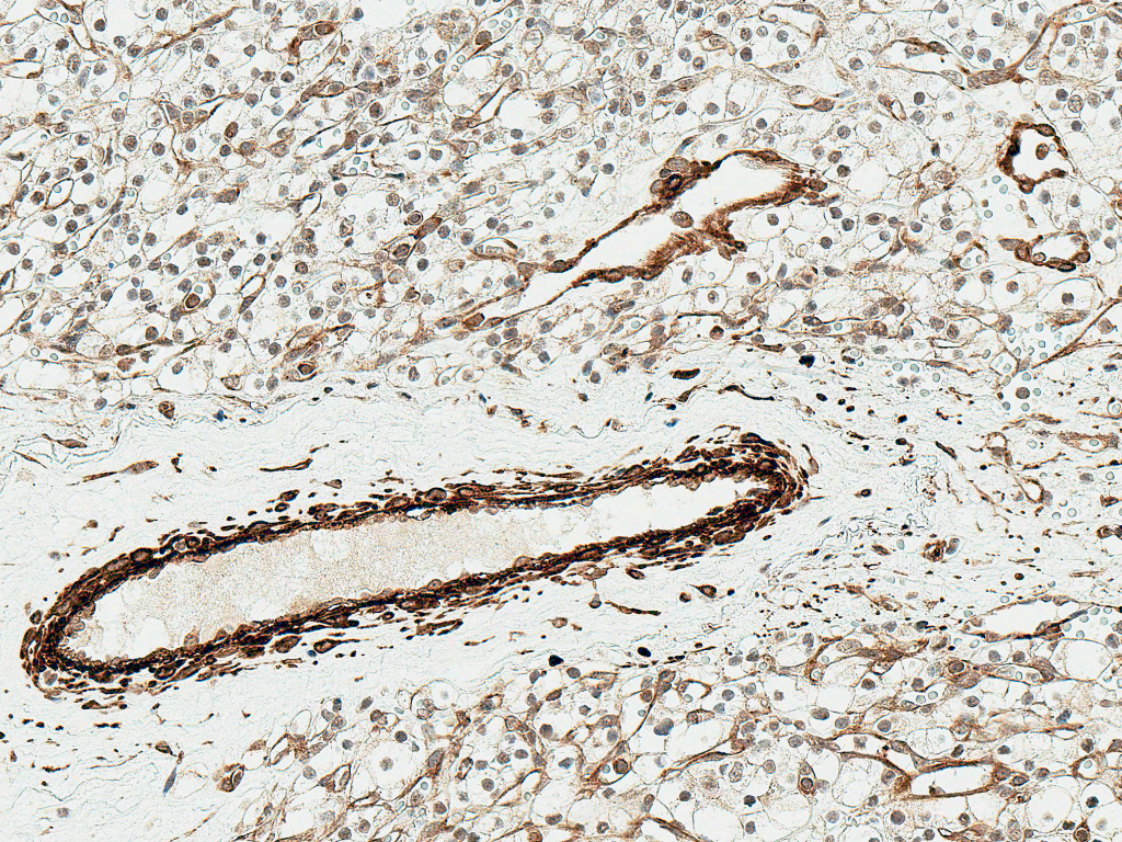 NFE2L2 / NRF2 Antibody (Biotin)