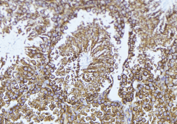PPP1R14A / CPI-17 Antibody