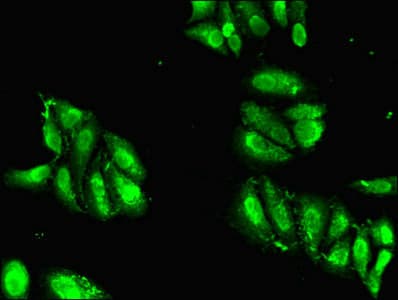 HIST1H2AG Antibody