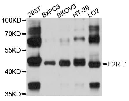 Polyclonal Rabbit anti-Human F2RL1 / PAR2 Antibody (WB)