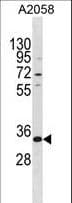 Polyclonal Rabbit anti-Human TGIF2LX Antibody (aa149-175, WB)