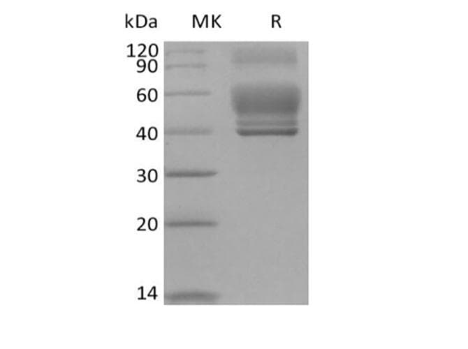 Human IL13 Protein (Recombinant Fc, C-terminus)