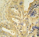 TLL1 Antibody (aa874-901)