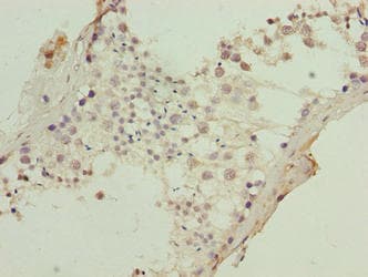 KRT80 / Keratin 80 Antibody