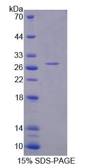 Human RFC5 Protein (Recombinant His, N-Terminal)