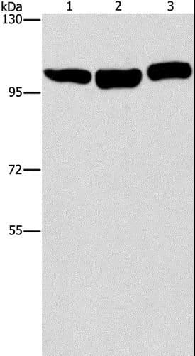 Polyclonal Rabbit anti-Human DNM2 / Dynamin-2 Antibody (IHC, WB)