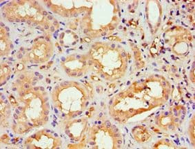 ASH2L / ASH2 Antibody (aa329-628)