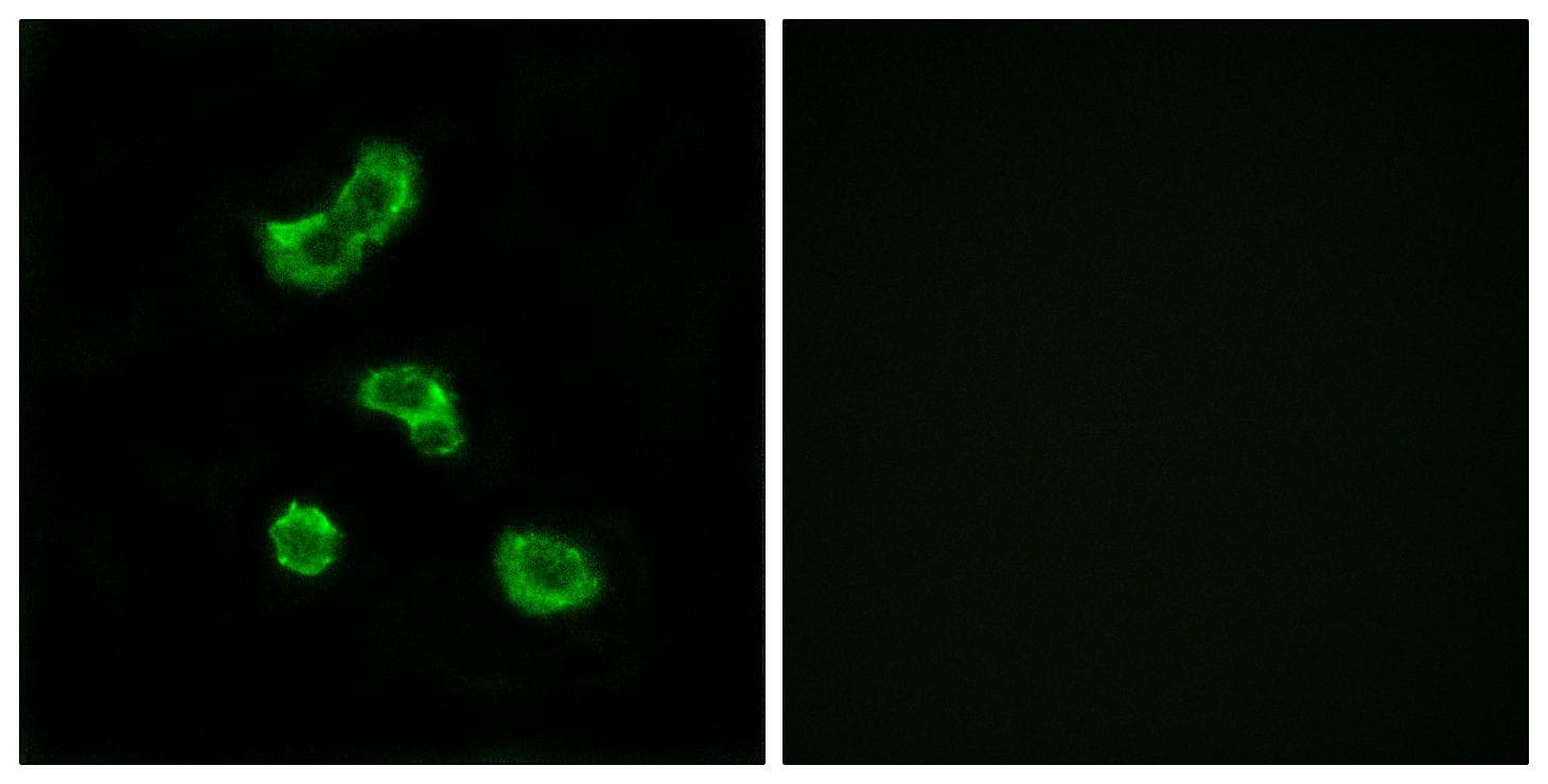 CA-VB / CA5B Antibody