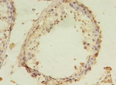 Polyclonal Rabbit anti-Human PPP2R4 Antibody (IHC, WB)