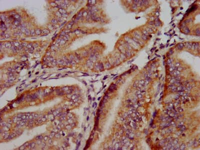 Polyclonal Rabbit anti-Human REPS1 Antibody (IHC, IF)
