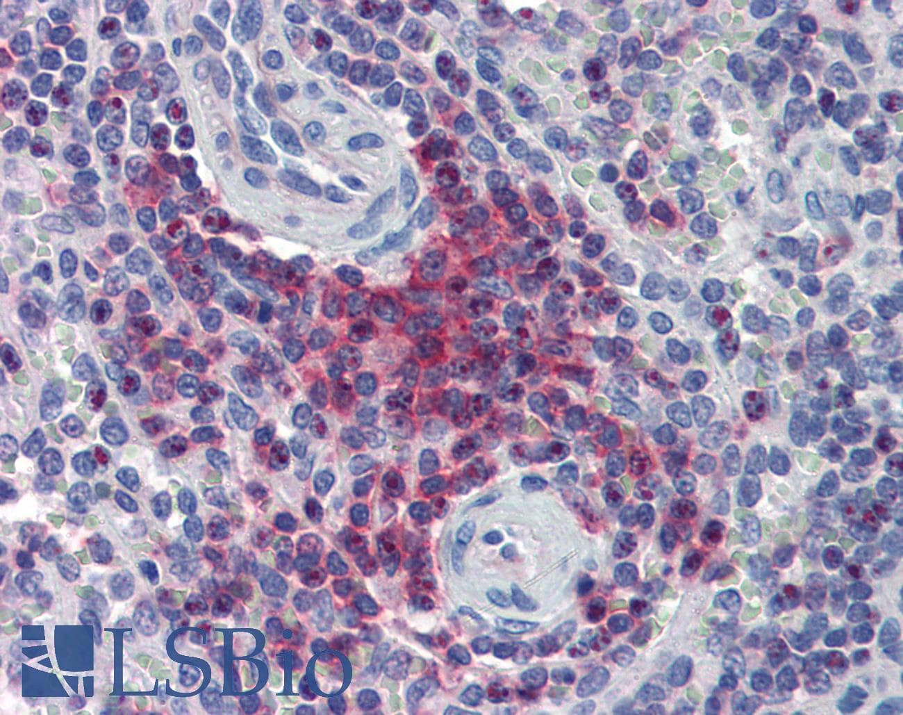IHC-plus™ LIME1 / LIME Antibody (aa141-295, clone Polyclonal)