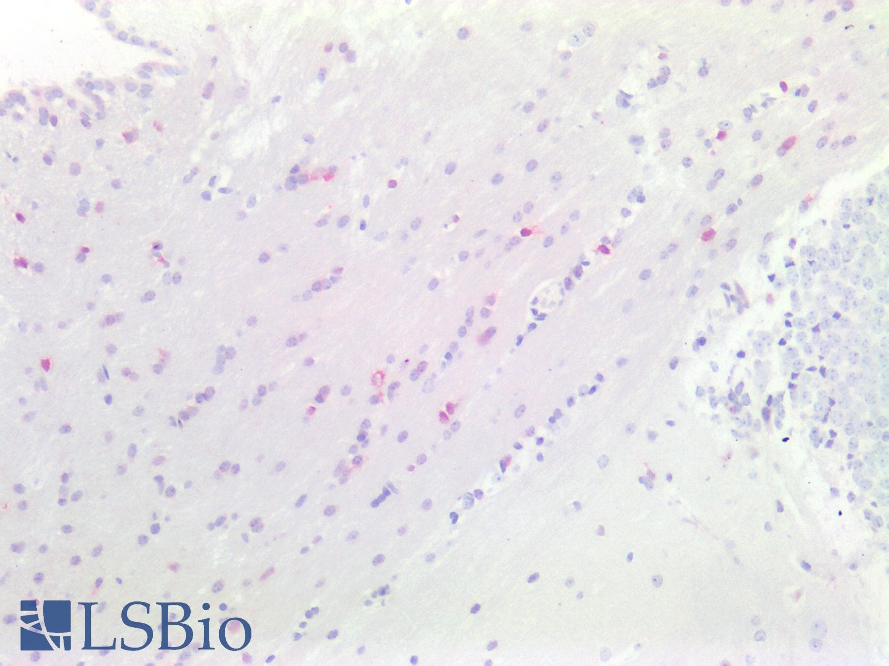 PathPlus™ Polyclonal Rabbit anti-Mouse OLIG1 Antibody (IHC, WB)