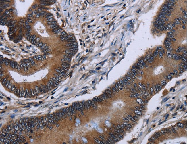 ITGAE / CD103 Antibody