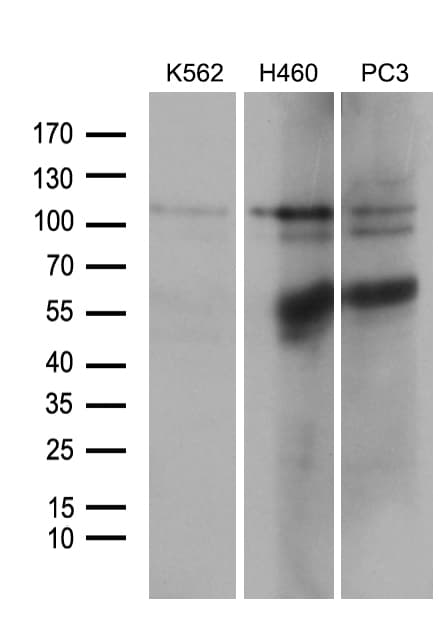 OTUD7B / Cezanne Antibody (aa449-729, clone OTI3D10)