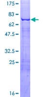 Human EKLF / KLF1 Protein (Recombinant GST)