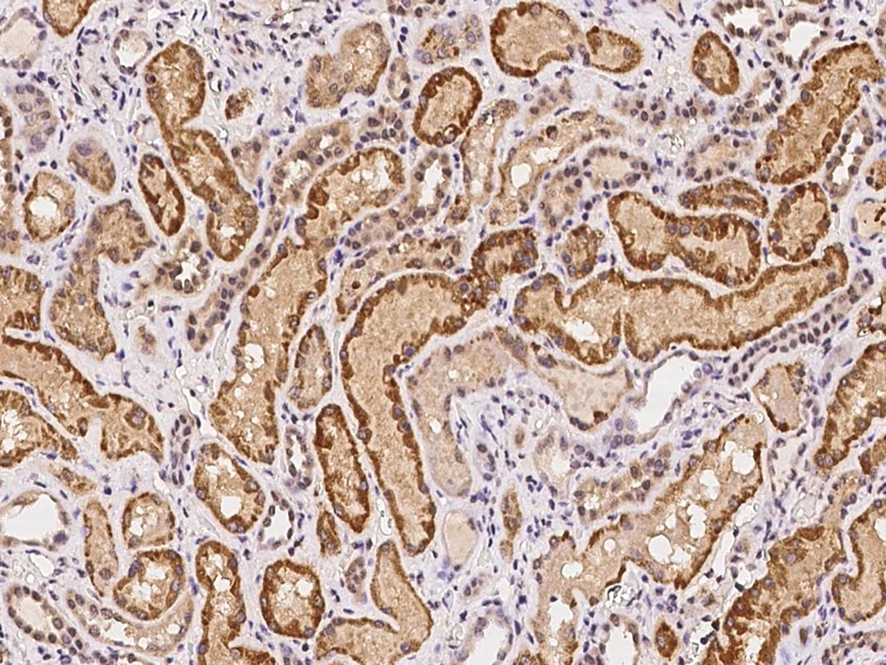 RPP14 Antibody