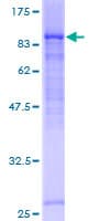 Human DCP1B Protein (Recombinant GST)