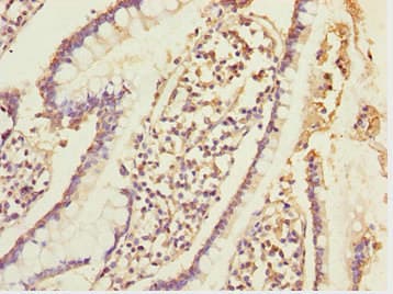 Polyclonal Rabbit anti-Human ERO1A / ERO1L Antibody (IHC, WB)
