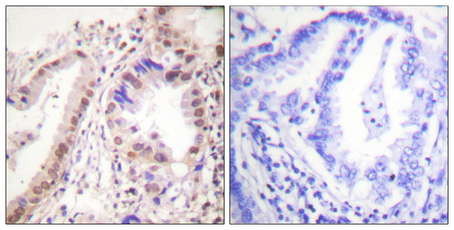 ER Alpha / Estrogen Receptor Antibody (p537)