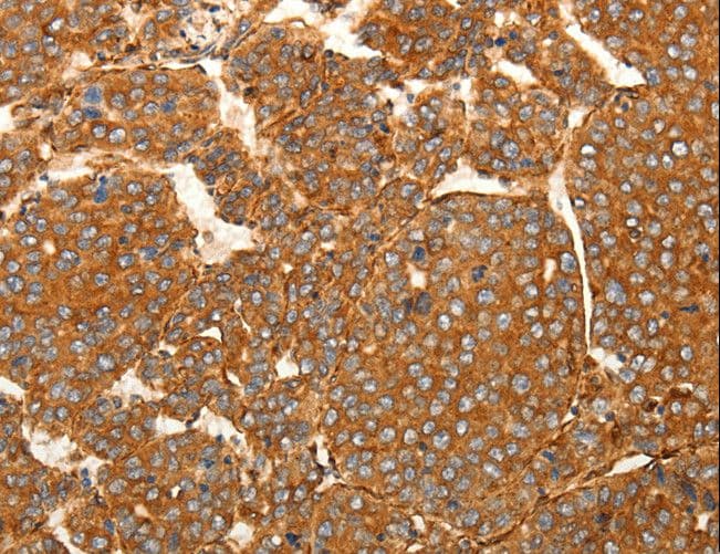 SFRP1 Antibody