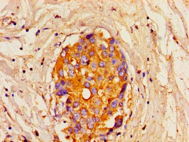 ITPR1 / IP3 Receptor Type 1 Antibody