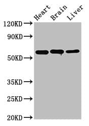 Polyclonal Rabbit anti-Human ALDH5A1 Antibody (aa48-535)