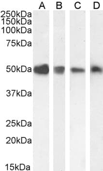 IHC-plus™ TXNDC5 / ERP46 Antibody (aa419-432)