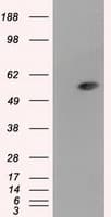 IHC-plus™ ALDH3A1 Antibody (clone 1B6)