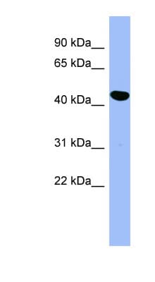 Polyclonal Rabbit anti-Human SERPINE2 / Nexin Antibody (aa251-300, WB)