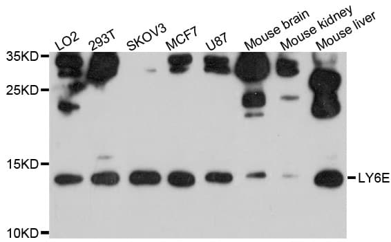 IHC-plus™ Polyclonal Rabbit anti-Human SCA2 / LY6E Antibody (IHC, WB)