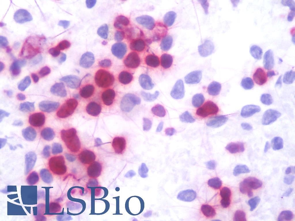 IHC-plus™ LMNB1 / Lamin B1 Antibody (clone 119D5-F1)