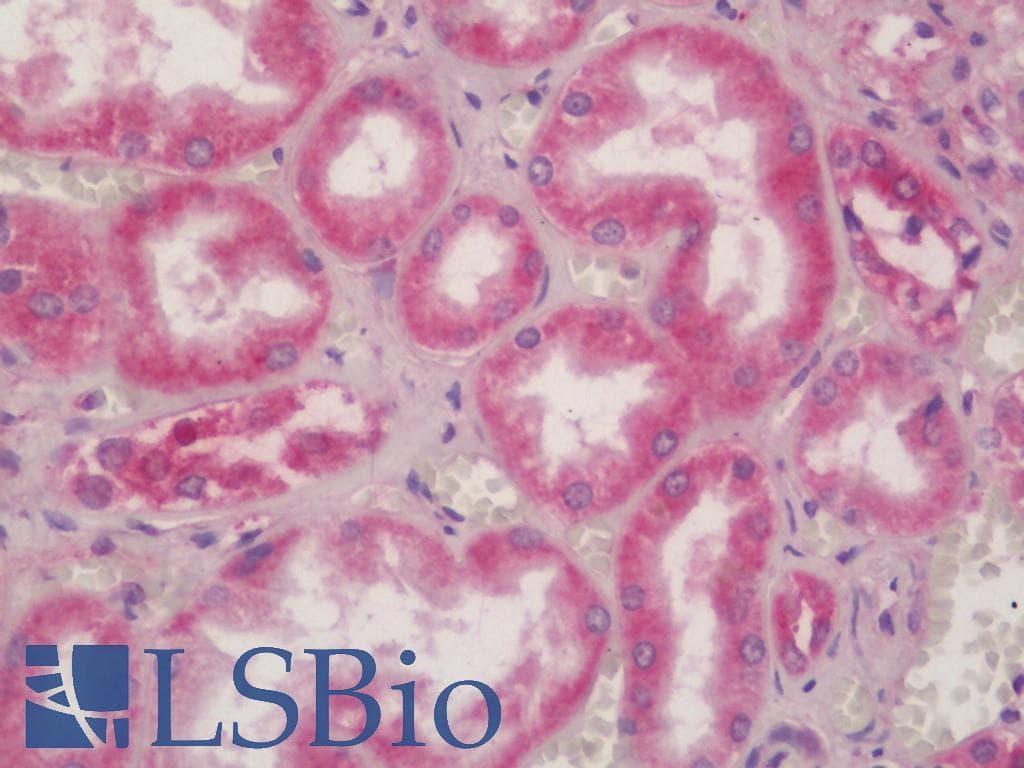 PathPlus™ PDGFRB / PDGFR Beta Antibody (clone RBT-PDGFRB)