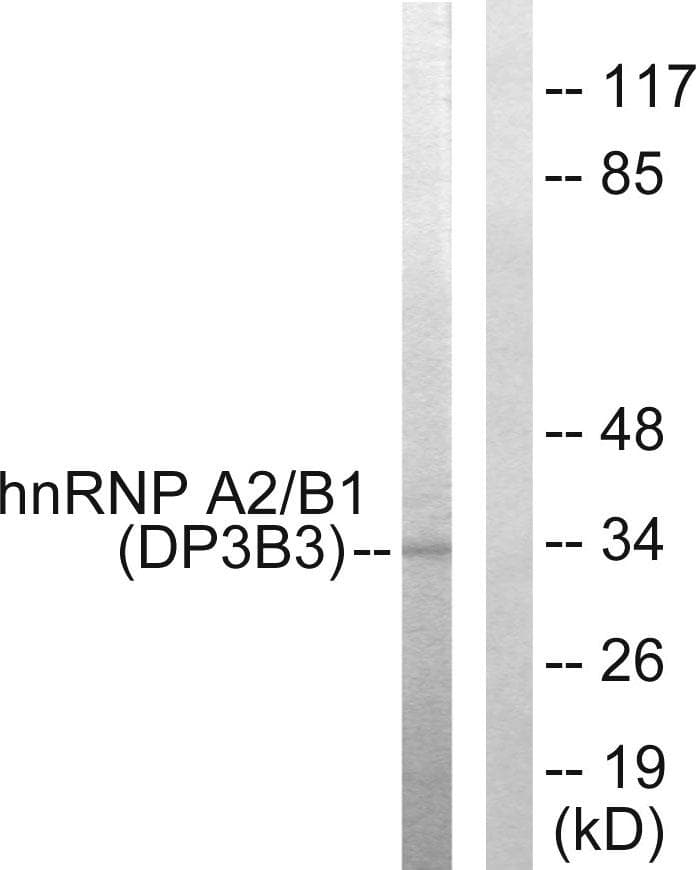 HNRNPA2B1 Antibody
