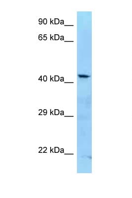 Polyclonal Rabbit anti-Human ADAT3 Antibody (aa260-309, WB)