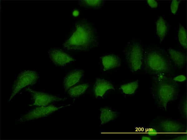 IHC-plus™ Monoclonal Mouse anti-Human GOK / STIM1 Antibody (clone 5A2, IHC, IF, WB)