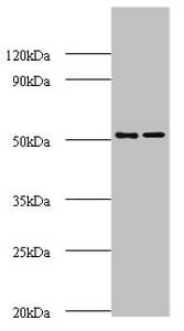 AP50 / AP2M1 Antibody