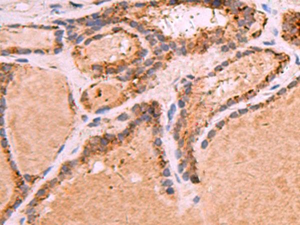 GPC2 / Glypican 2 Antibody