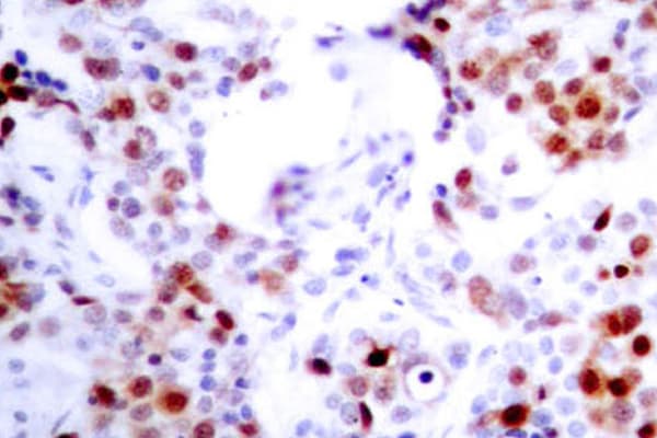 ATF2 Antibody (Val63/45)