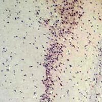 CABP2 Antibody