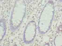 KHDRBS2 / SLM-1 Antibody