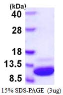 Mouse S100A1 / S100-A1 Protein (Recombinant His)