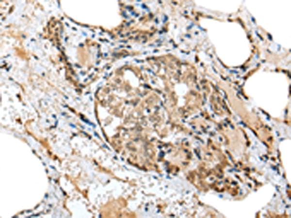 TPPP Antibody