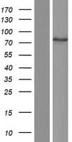TTC39B Protein (Over-Expression Lysate Myc-DDK (Flag))