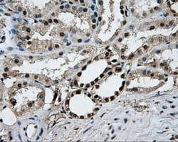 PKMYT1 Antibody (clone OTI5E1)