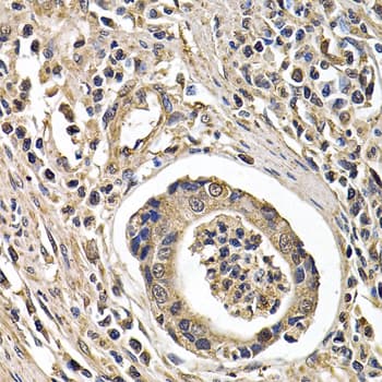 Polyclonal Rabbit anti-Human ARRB2 / Beta Arrestin 2 Antibody (IHC, IF, WB)